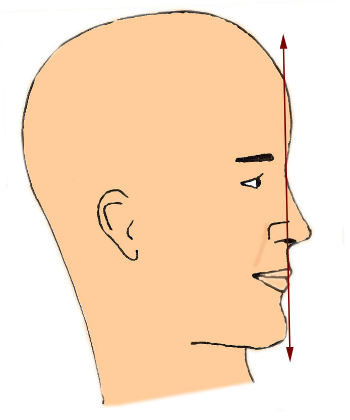 classificationprofil-rhinoplastie-chirurgie-esthetique