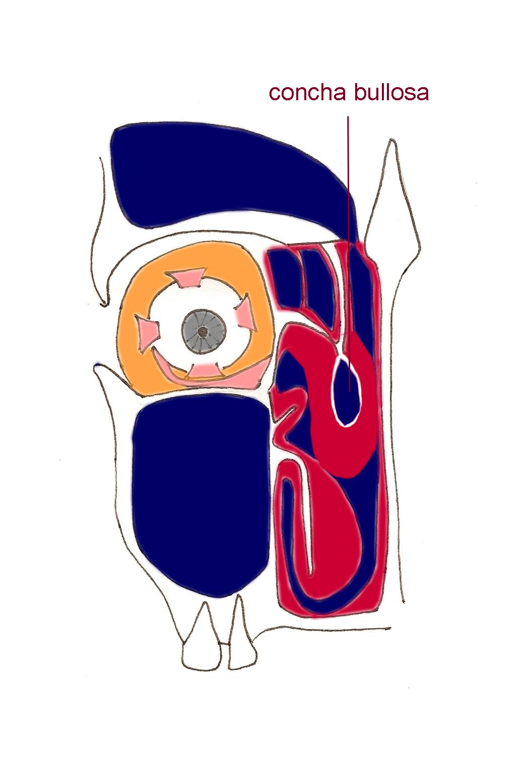 conchabullosa-rhinite-obstruction-nasale-nez-bouche