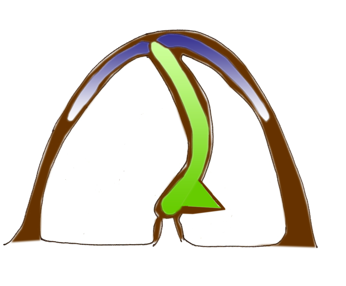 eperon-septum-cloison-nasale-chirurgie-esthetique-rhinoplastie