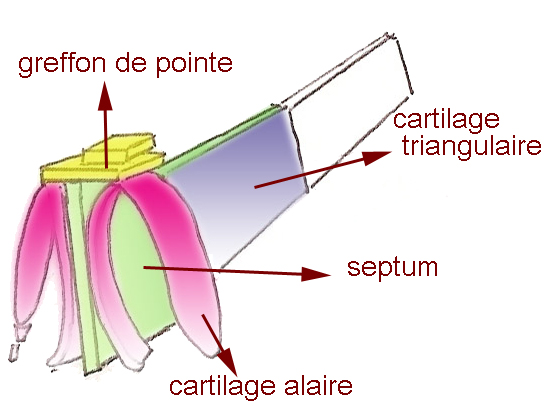 greffon-pointe-nez-chirurgie-esthetique-rhinoplastie