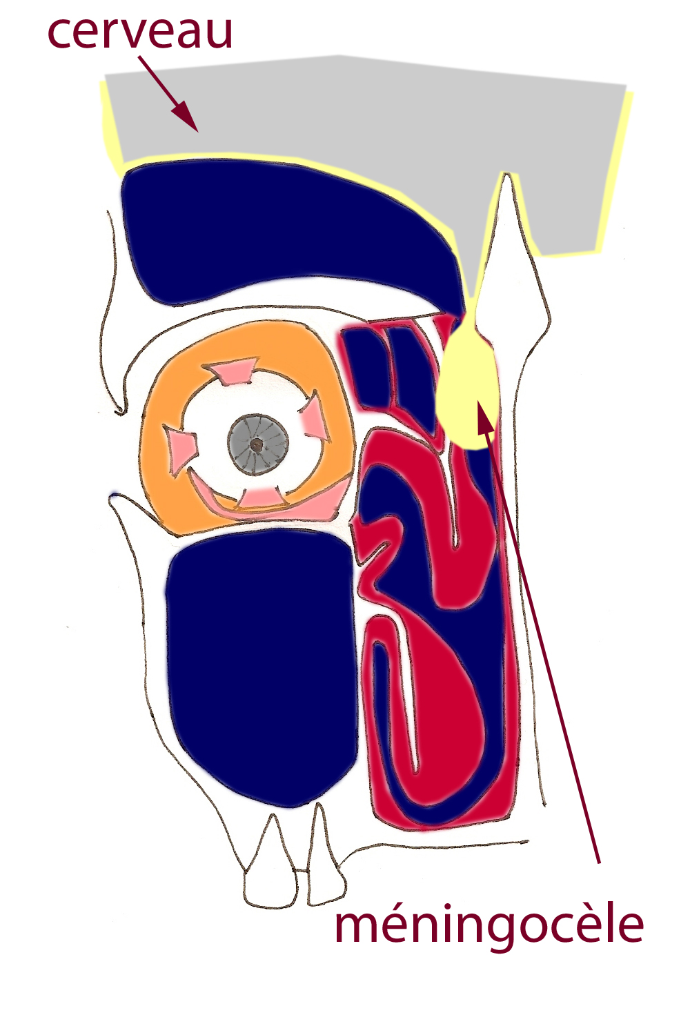 meningocele-sinus-obstruction-nasale-nez-bouche