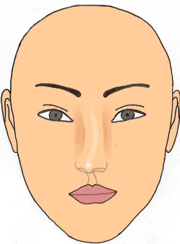 deviation-nez-chirurgie-esthetique-rhinoplastie