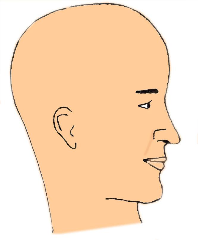 nez-grand-pointe-tombante-chirurgie-esthetique-rhinoplastie