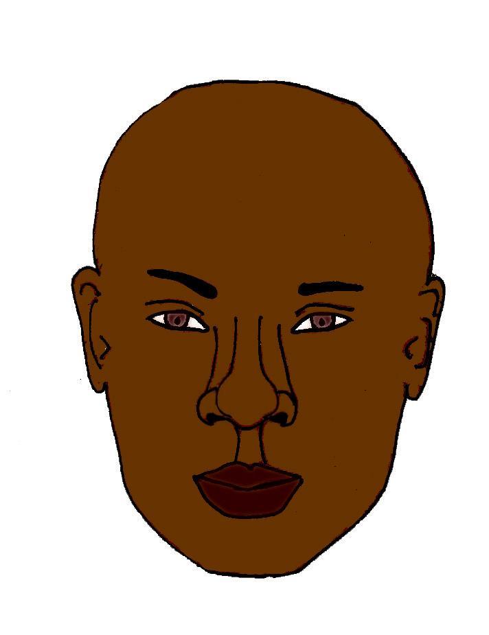 nez-noir-gros-nez-pointe-large-chirurgie-esthetique-rhinoplastie
