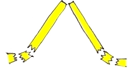 osteotomie-double-gros-nez-chirurgie-esthetique-rhinoplastie