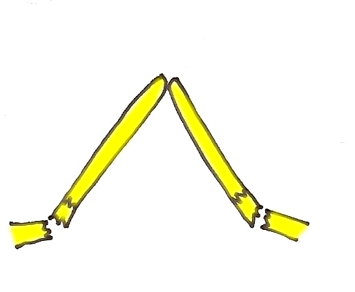 osteotomie-fermee-rhinoplastie-chirurgie-esthetique