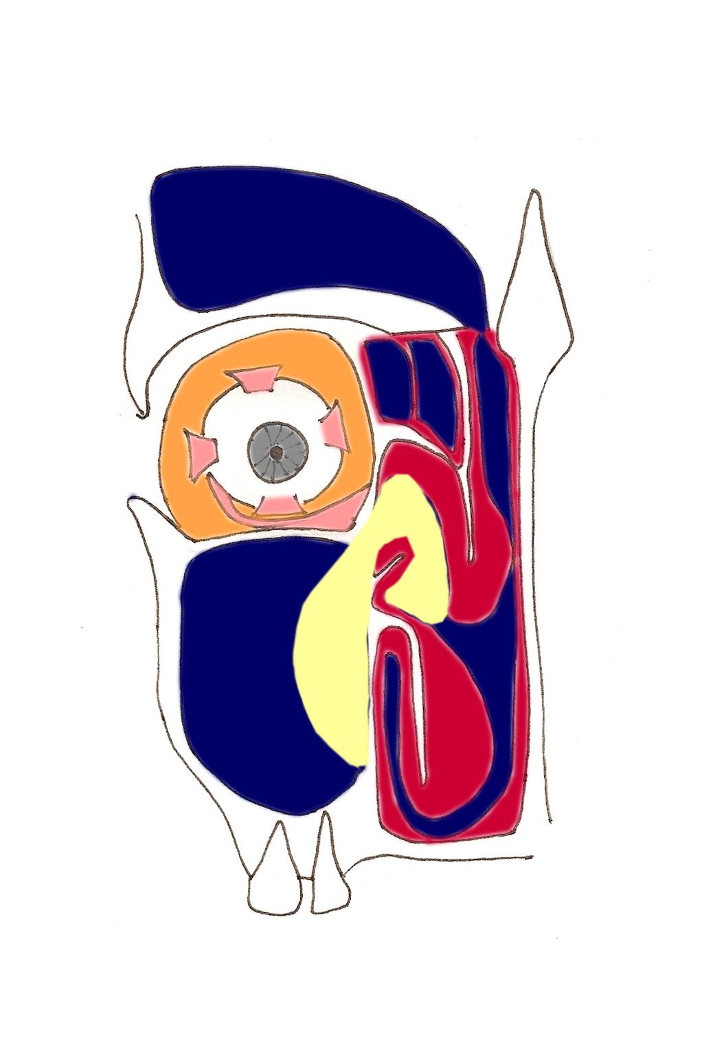 polype-killian-obstruction-nasale-nez-bouche