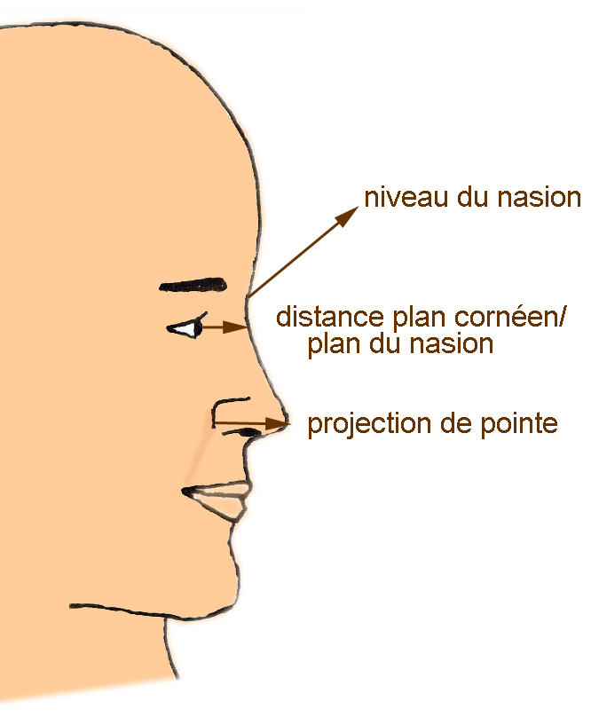 projection-pointe-de-nez-idéale-chirurgie-esthetique