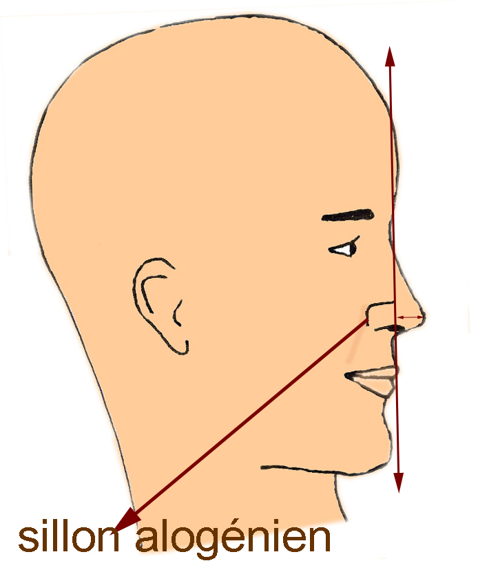 projection-pointe-nez-grand-rhinoplastie-chirurgie-esthetique