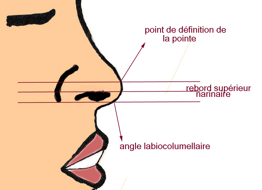 proportions-narines-rhinoplastie-chirurgie-esthetique