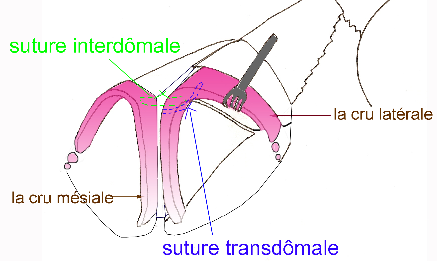 suture-interdomale-chirurgie-esthetique-rhinoplastie
