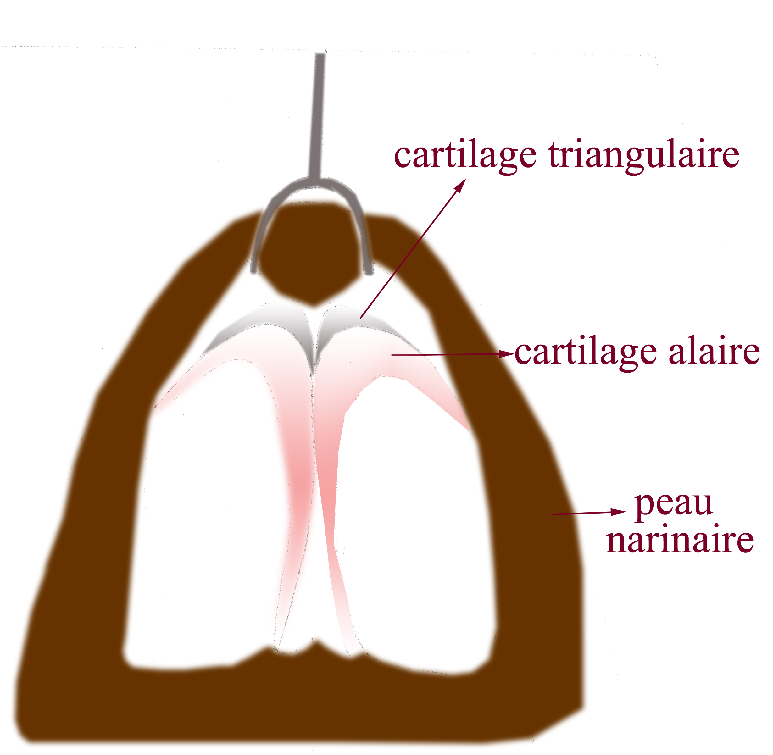 voie-externe-rhinoplastie-chirurgie-esthetique